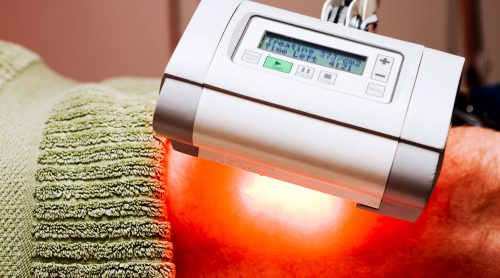 Photodynamische Therapie